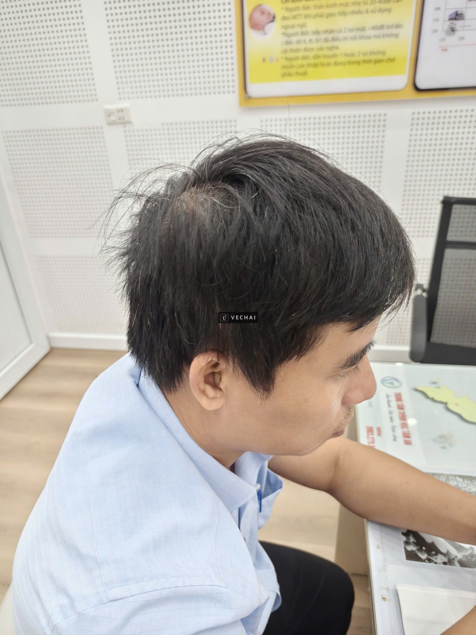 Phonak Terra+ RIC 312 – Giải pháp trợ thính thế hệ mới, giúp bạn nghe rõ, nói tự tin mọi nơi.