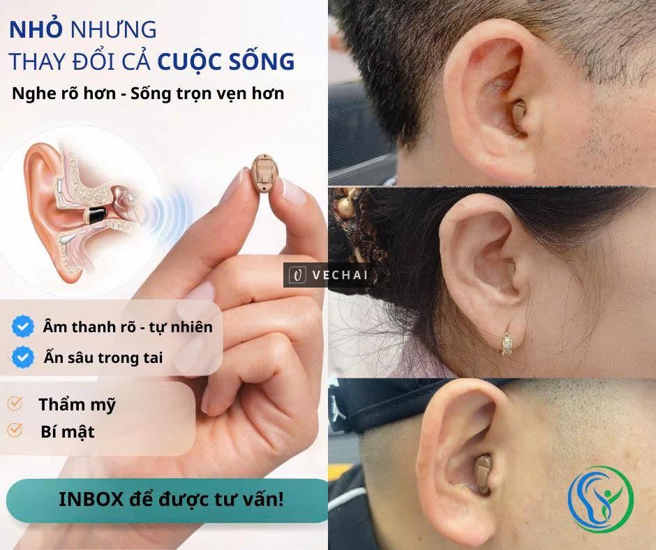 Giải pháp giúp nghe rõ hơn tại Thái Bình