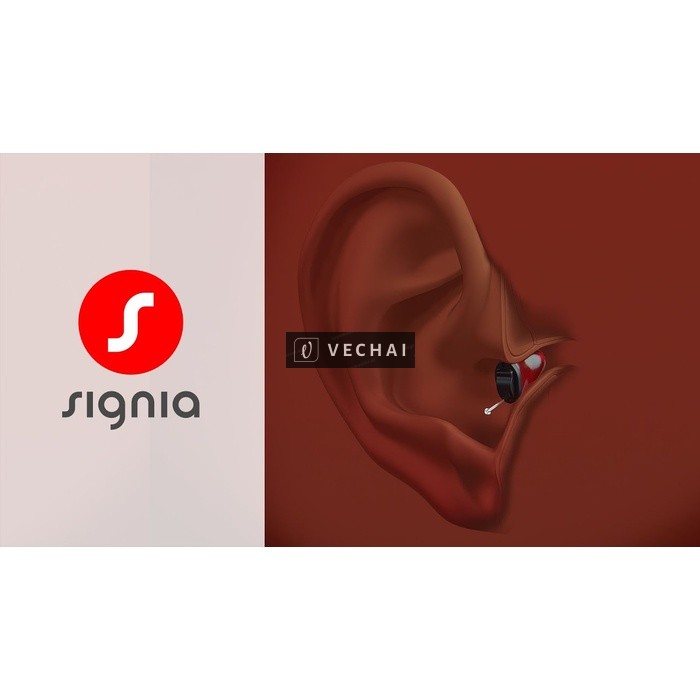 Bạn gặp khó khăn khi nói chuyện nơi đông người?